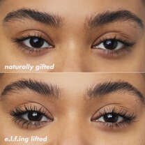 Brow Lift